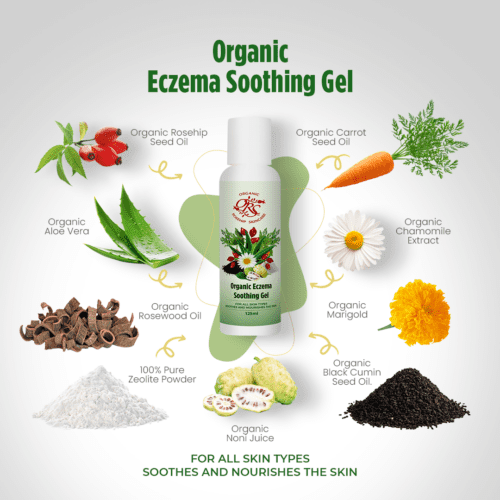 organic eczema soothing gel