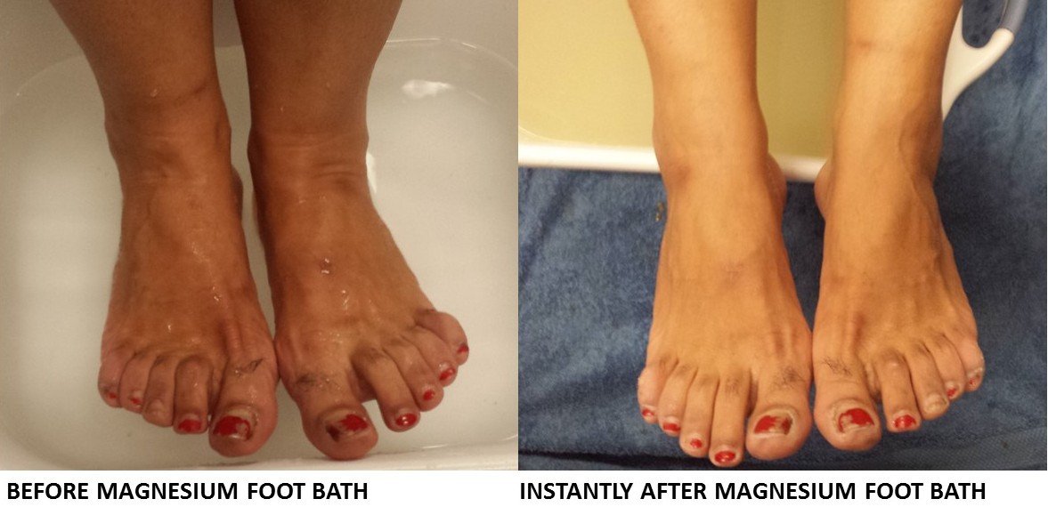 Magnesium Foot Bath