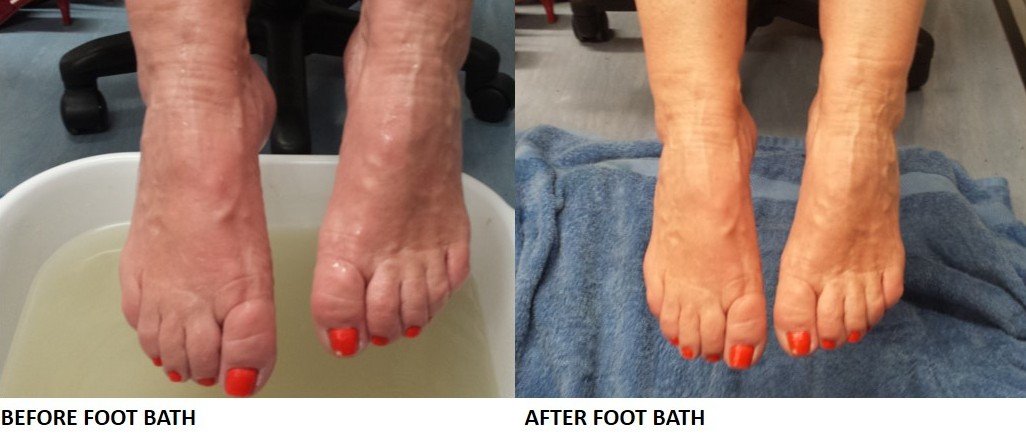 Before & After Magnesium Foot Bath