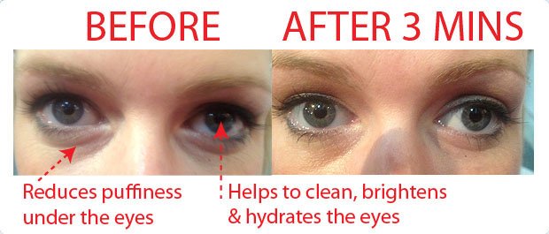eye soother before and after